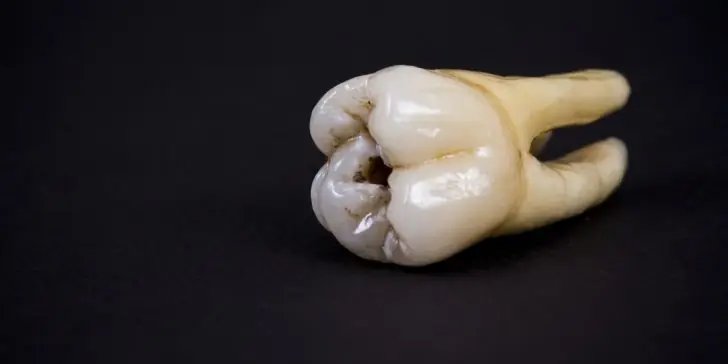 John Lennon's tooth got sold for an astounding $31,200 at the auction last Saturday.